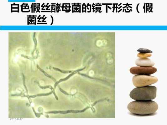 白色或类白色（白色或类白色疏松体 crisp）-图1