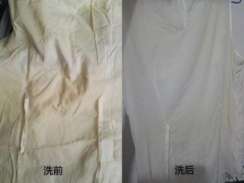 白色衣服变黄怎么洗（白色衣服变黄怎么洗才能变白）-图3