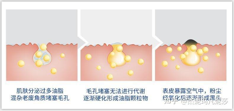 白色油脂怎么去除（白色油脂怎么去除小妙招）-图3