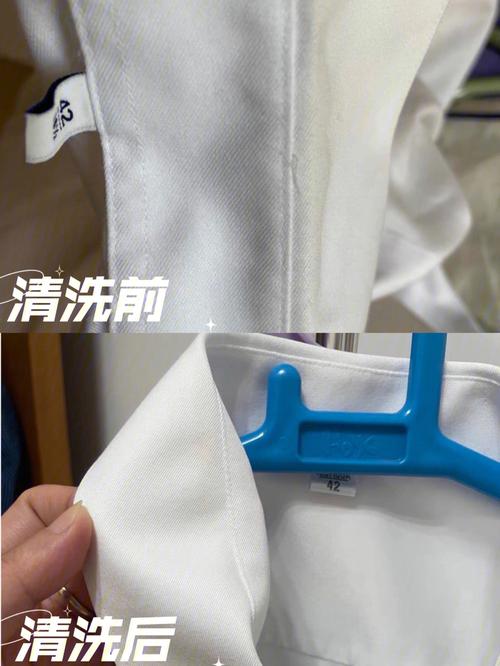 怎样去除白色衣服上的污渍（怎么样才能去除白色衣服上的污渍）-图1